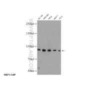 ELAC2 Rabbit Polyclonal Antibody (10071-1-AP)