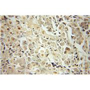 MAPK8 Rabbit Polyclonal Antibody (10023-1-AP)