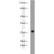 CBX1 Rabbit Polyclonal Antibody (10241-2-AP)