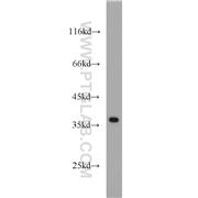 APEX1 Rabbit Polyclonal Antibody (10323-1-AP)