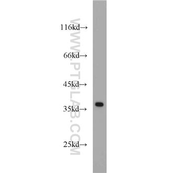 APEX1 Rabbit Polyclonal Antibody (10323-1-AP)