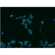PIN1 Rabbit Polyclonal Antibody (10495-1-AP)