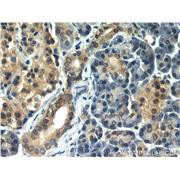 UBB Rabbit Polyclonal Antibody (10201-2-AP)