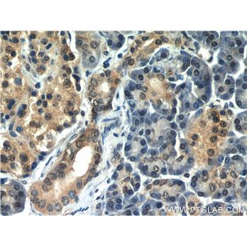 UBB Rabbit Polyclonal Antibody (10201-2-AP)