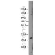 BAD Rabbit Polyclonal Antibody (10435-1-AP)