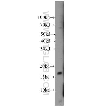 BAD Rabbit Polyclonal Antibody (10435-1-AP)