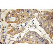 ATG5 Rabbit Polyclonal Antibody (10181-2-AP)
