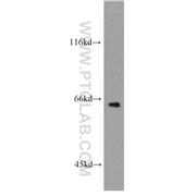 GPAA1 Rabbit Polyclonal Antibody (10104-1-AP)