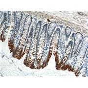 KRT8 Rabbit Polyclonal Antibody (10384-1-AP)