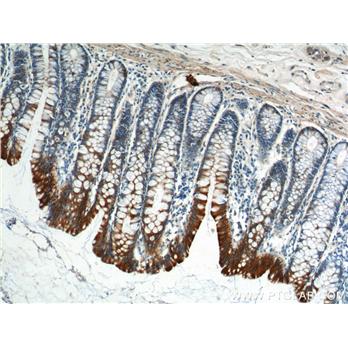KRT8 Rabbit Polyclonal Antibody (10384-1-AP)