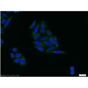 IGFBP3 Rabbit Polyclonal Antibody (10189-2-AP)