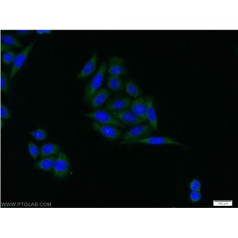 IGFBP3 Rabbit Polyclonal Antibody (10189-2-AP)