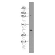 UBE2T Rabbit Polyclonal Antibody (10105-2-AP)