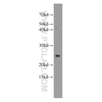 UBE2T Rabbit Polyclonal Antibody (10105-2-AP)