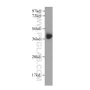 B4GALT7 Rabbit Polyclonal Antibody (10535-1-AP)