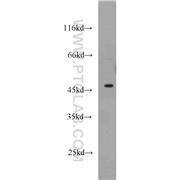 GATA3 Rabbit Polyclonal Antibody (10417-1-AP)