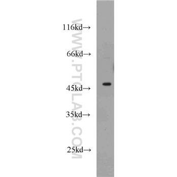 GATA3 Rabbit Polyclonal Antibody (10417-1-AP)