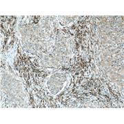 SSR2 Rabbit Polyclonal Antibody (10278-1-AP)