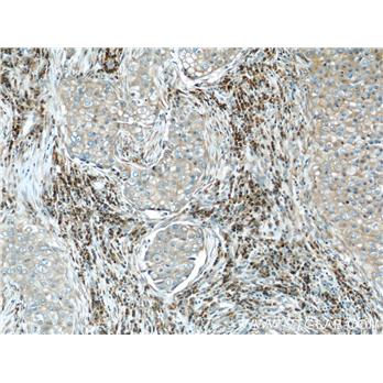SSR2 Rabbit Polyclonal Antibody (10278-1-AP)
