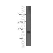 SNRPD1 Rabbit Polyclonal Antibody (10352-1-AP)