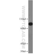 RRM1 Rabbit Polyclonal Antibody (10526-1-AP)