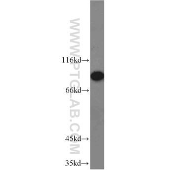RRM1 Rabbit Polyclonal Antibody (10526-1-AP)