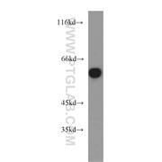 MAPK7 Rabbit Polyclonal Antibody (10036-2-AP)