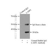 LASP1 Rabbit Polyclonal Antibody (10515-1-AP)