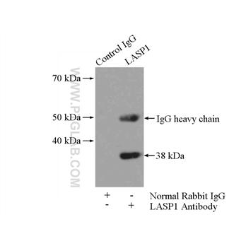 LASP1 Rabbit Polyclonal Antibody (10515-1-AP)