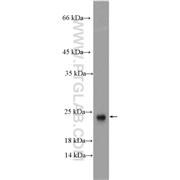 ARL2BP Rabbit Polyclonal Antibody (10090-2-AP)