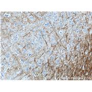 MBP Rabbit Polyclonal Antibody (10458-1-AP)