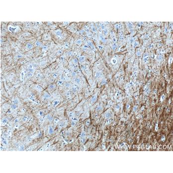 MBP Rabbit Polyclonal Antibody (10458-1-AP)