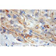 RCN2 Rabbit Polyclonal Antibody (10193-2-AP)