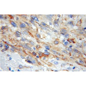 RCN2 Rabbit Polyclonal Antibody (10193-2-AP)