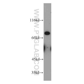 MFI2 Rabbit Polyclonal Antibody (10428-1-AP)