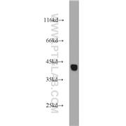 HSPBP1 Rabbit Polyclonal Antibody (10211-1-AP)