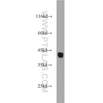 HSPBP1 Rabbit Polyclonal Antibody (10211-1-AP)