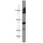GDI2 Rabbit Polyclonal Antibody (10116-1-AP)