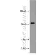 RBM14 Rabbit Polyclonal Antibody (10196-1-AP)