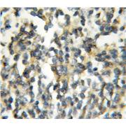 PAFAH2 Rabbit Polyclonal Antibody (10085-1-AP)