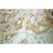 PLEKHA1 Rabbit Polyclonal Antibody (10238-1-AP)