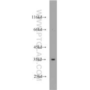 GNB3 Rabbit Polyclonal Antibody (10081-1-AP)
