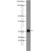ARL4C Rabbit Polyclonal Antibody (10202-1-AP)