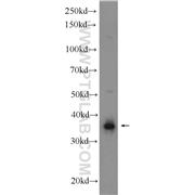 STOML2 Rabbit Polyclonal Antibody (10348-1-AP)