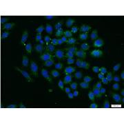 PXN Rabbit Polyclonal Antibody (10029-1-Ig)