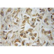 LRRC1 Rabbit Polyclonal Antibody (10128-2-AP)