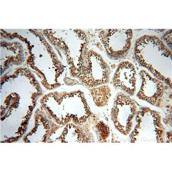 FKBPL Rabbit Polyclonal Antibody (10060-1-AP)