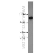 DDX50 Rabbit Polyclonal Antibody (10358-1-AP)
