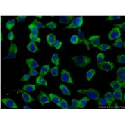 GRB7 Rabbit Polyclonal Antibody (10045-1-Ig)