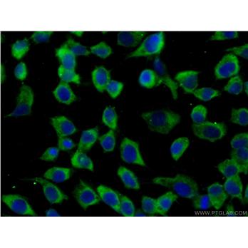 GRB7 Rabbit Polyclonal Antibody (10045-1-Ig)